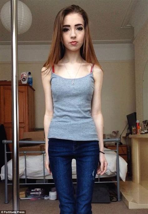 anorexic nude|Free Anorexic Porn Videos (128) .